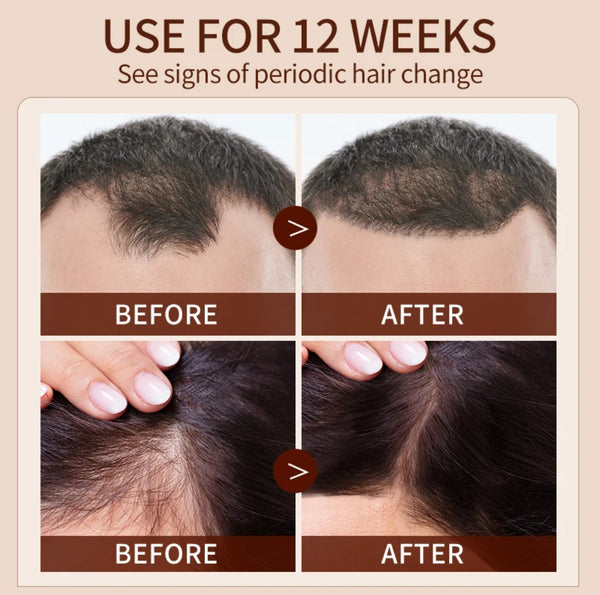 Hair Growth Oil